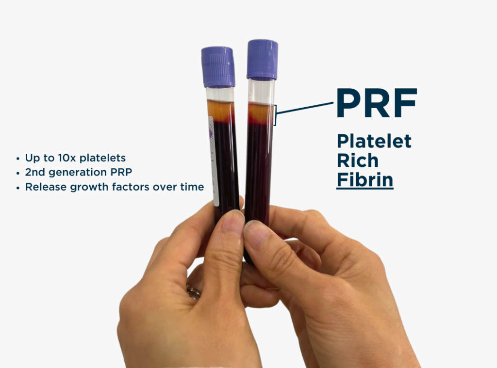 Clean Prf PRF for Acne Scars | Hair and Skin Science