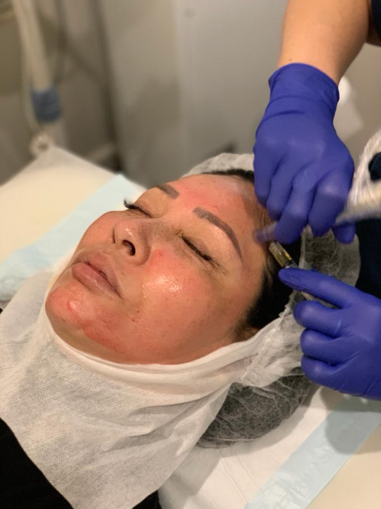 What is PRP skin treatment? 2 What is PRP skin treatment? 2
