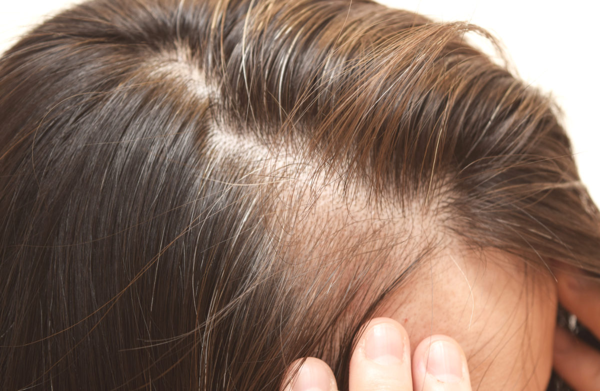 How to Get Thicker Hair 1 How to Get Thicker Hair 1