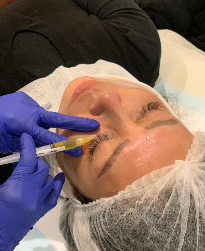 What is PRP skin treatment? 1 What is PRP skin treatment? 1
